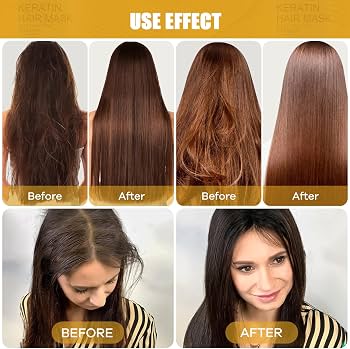 Royalliness Hair Mask _ Anti-Hair Loss & Oil Control